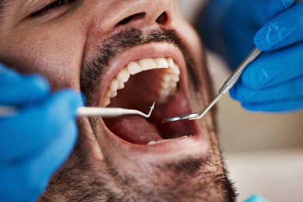 Best Cracked Tooth Emergency Dentist  in Calcium, NY